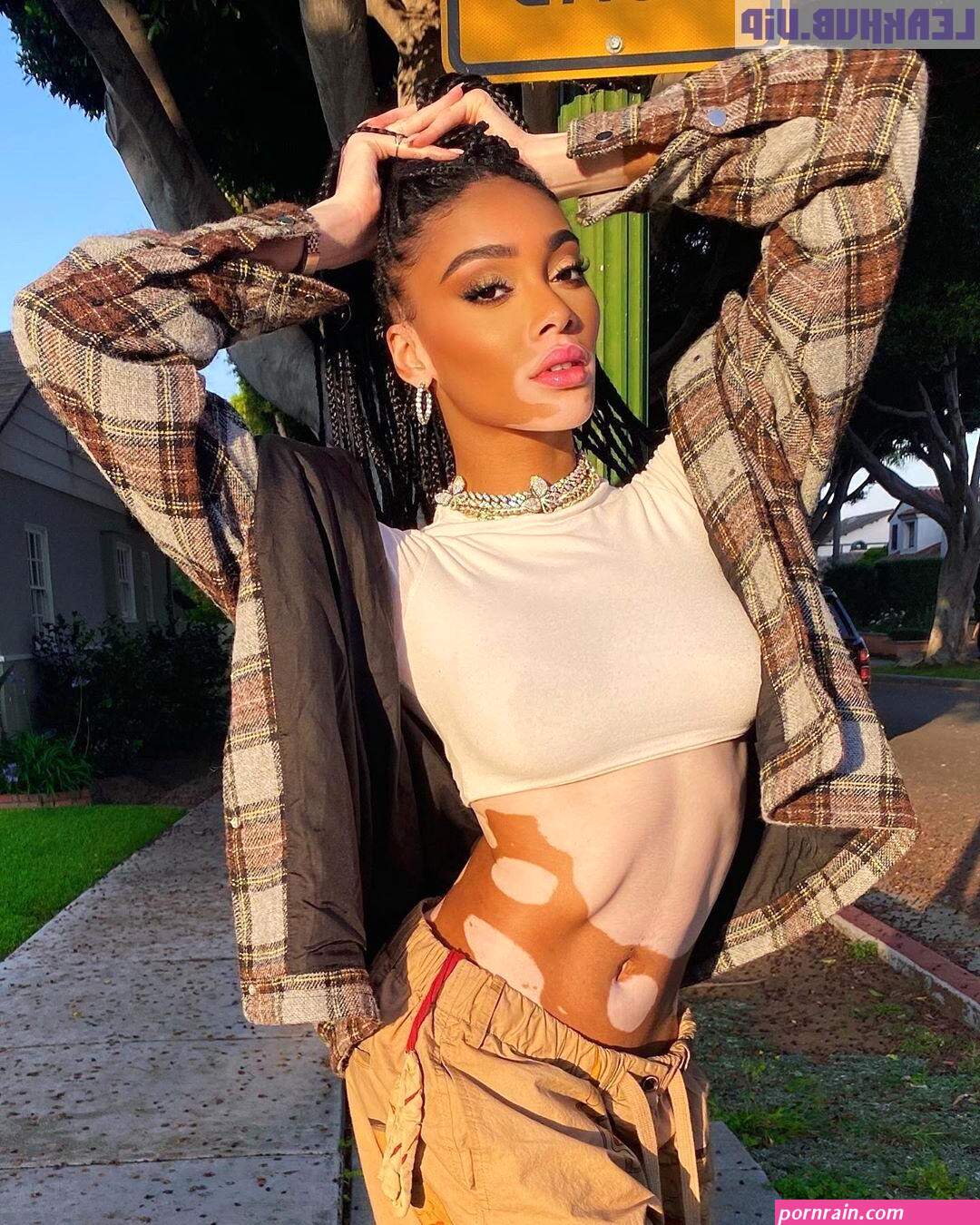 winnie harlow nuda