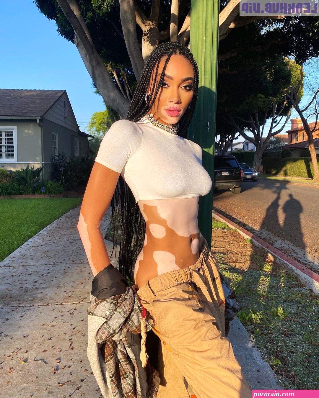 winnie harlow nuda