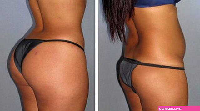 30 ml West Africa Buttock Exercise Butt Enlargement Oil Breast Enhancement  Hips Enlarge Hip Fat Cells Get Bigger butt By Walking _