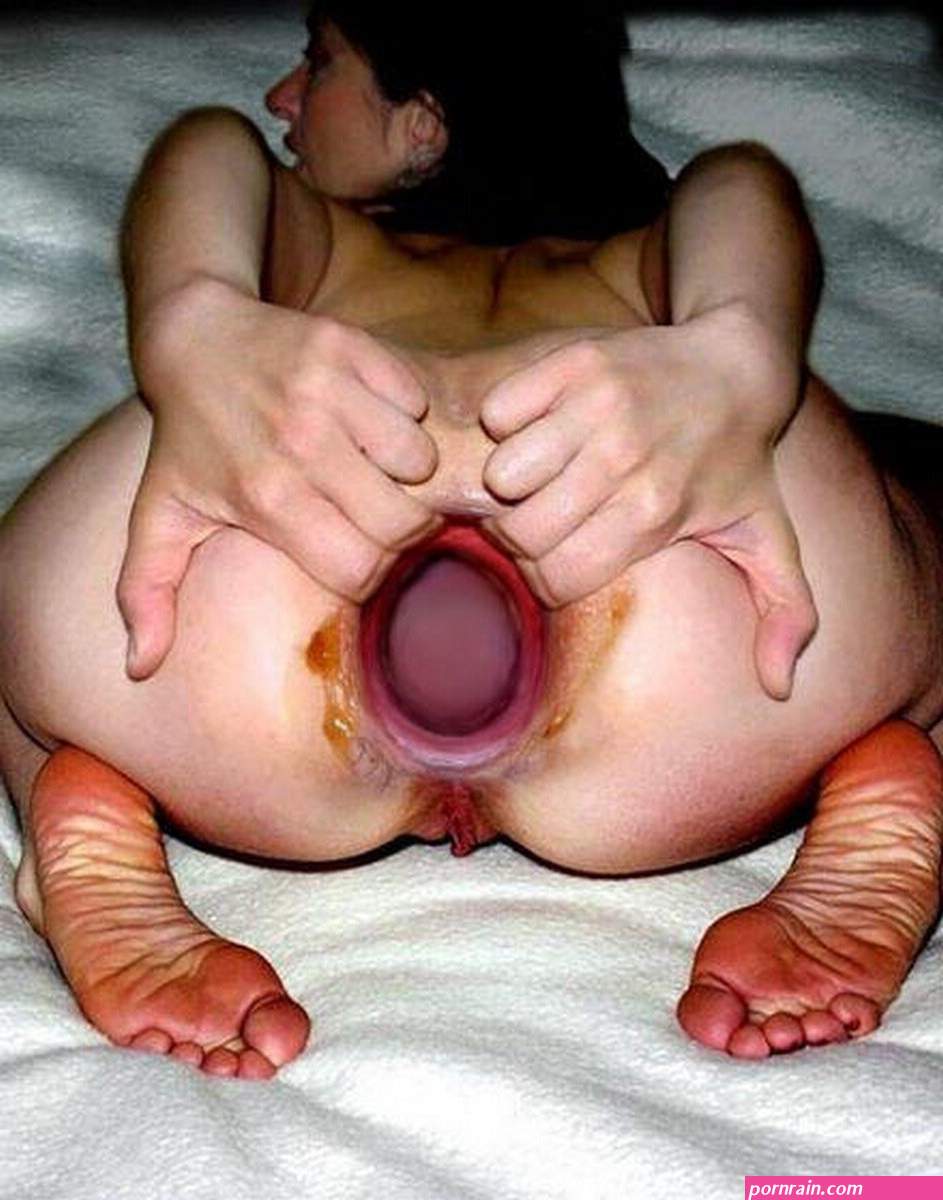 Brutal-dildos-anal-insertion-and-anal-prolapse-28.jpg | MOTHERLESS.COM ™