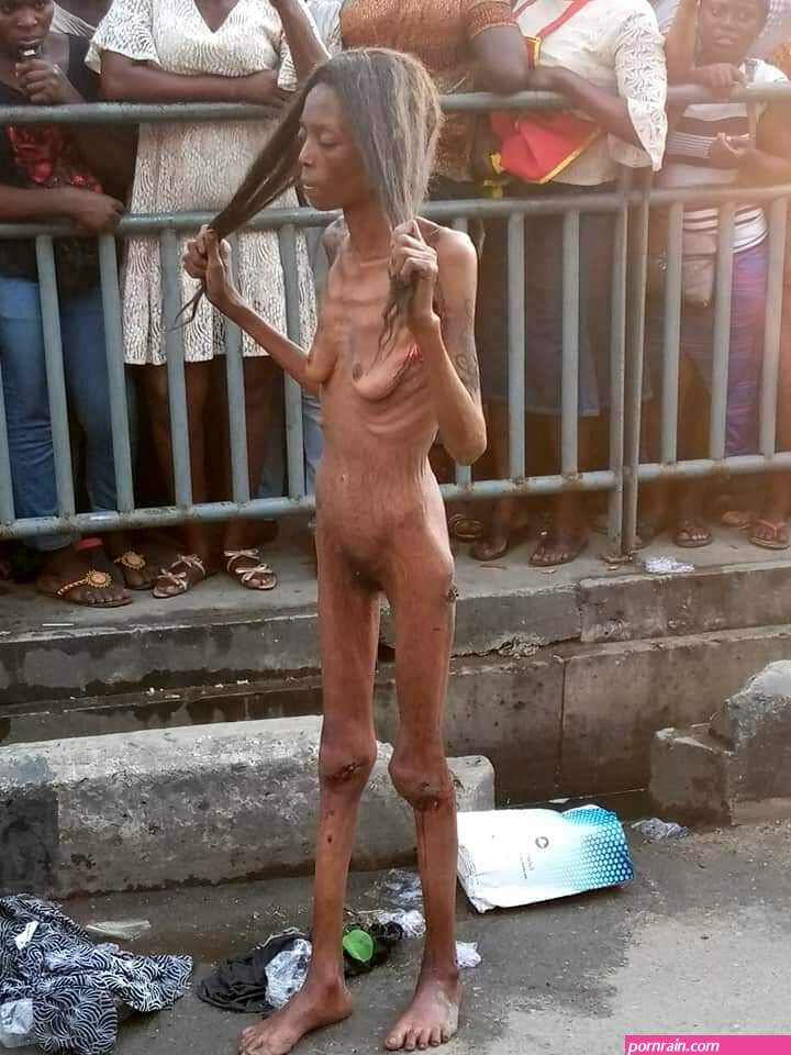 Update: SHOCKING!!! Naked Lagos Girl shrunken to bones, shows up in Ajah, Lagos (Photos) -
