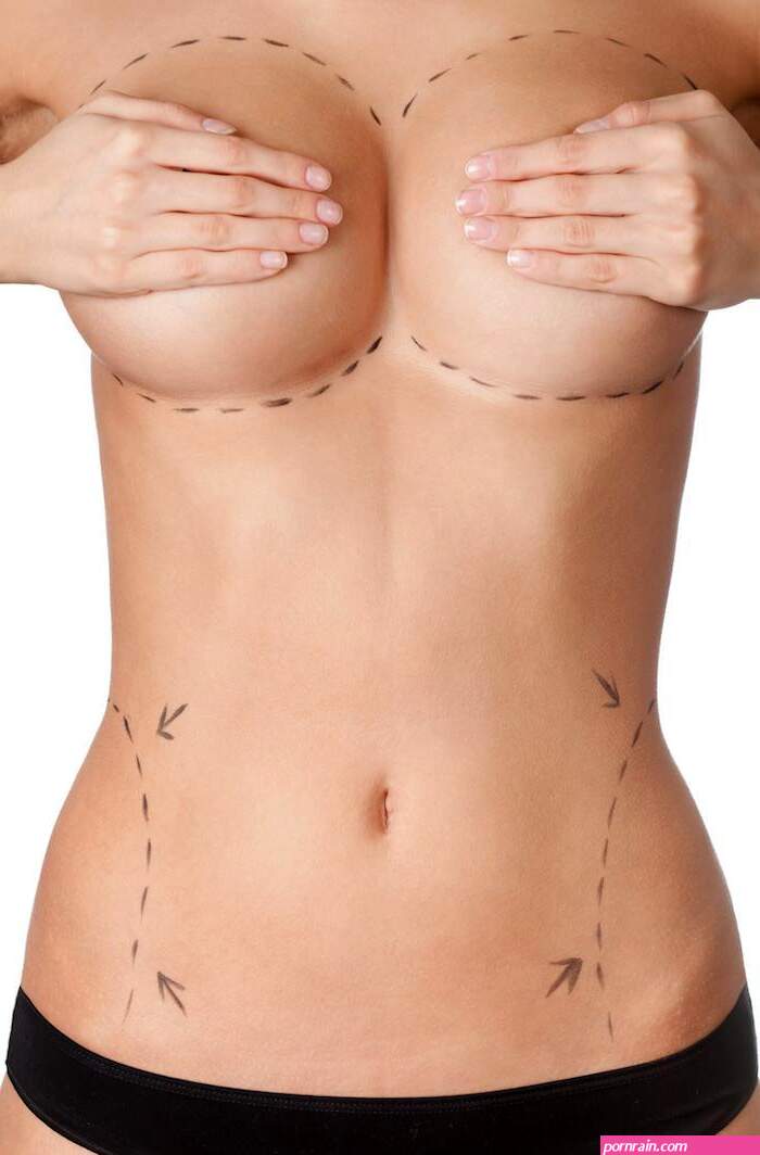 Choosing the Right Breast Implants for Your Body: Kiran Polavarapu MD: Cosmetic Surgeon