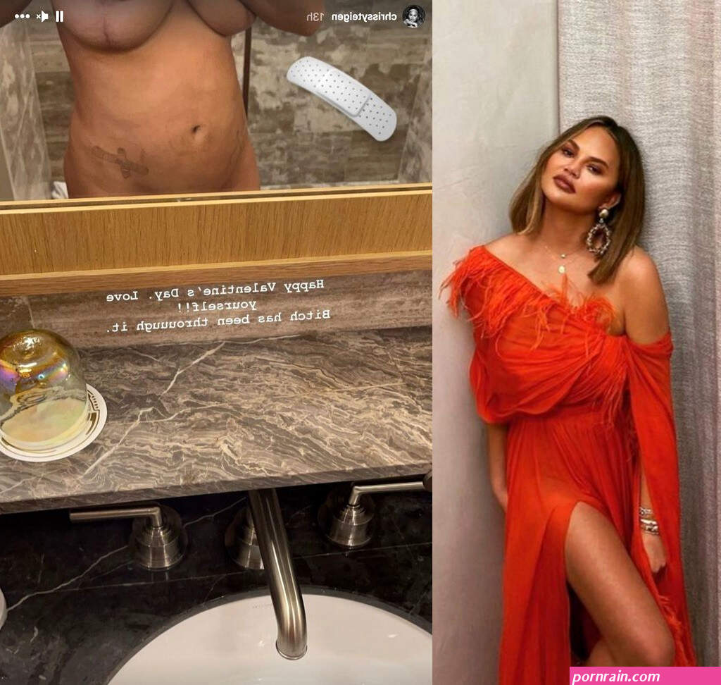 Chrissy Teigen poses nude to show off scarred figure after surgery