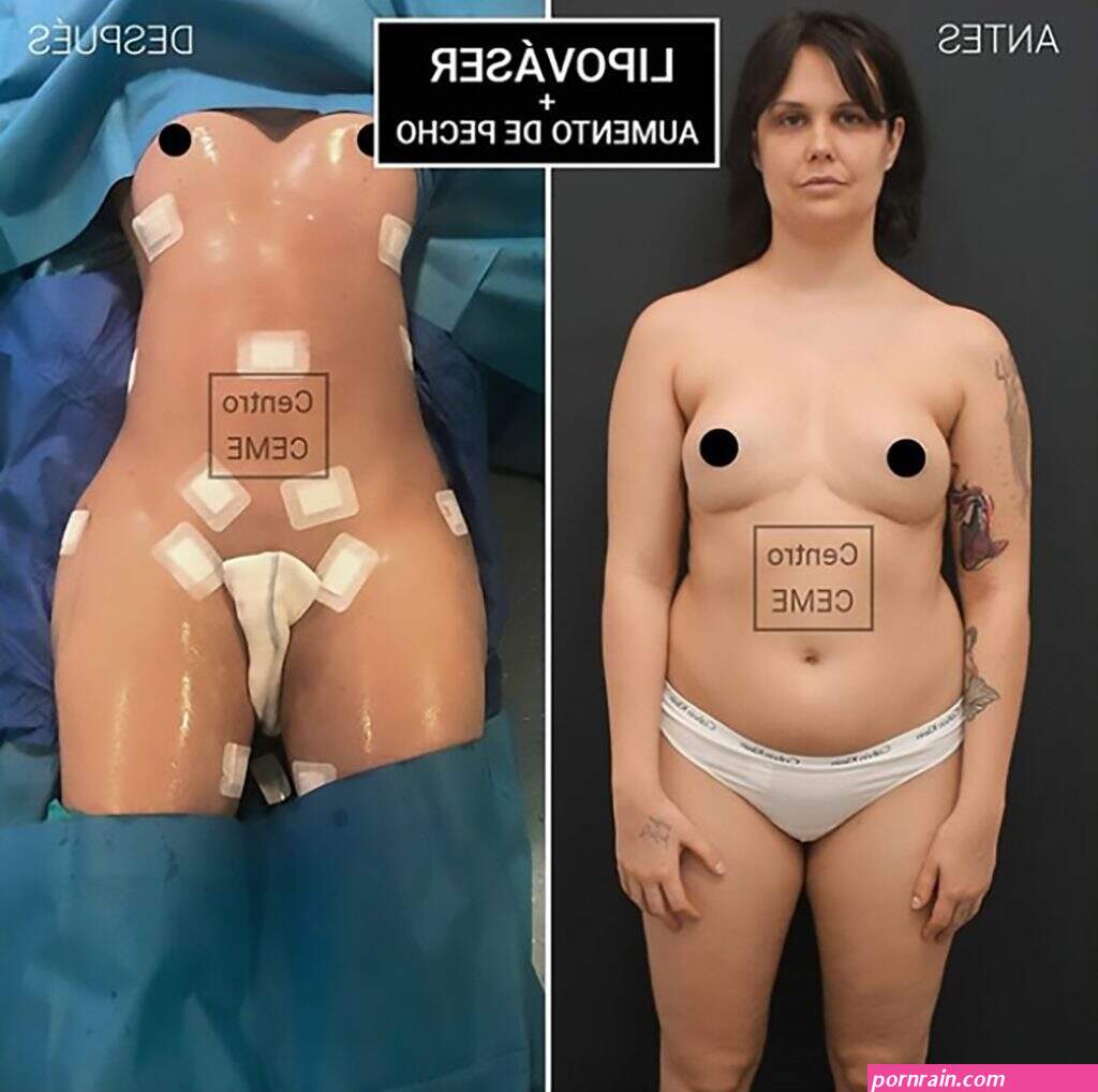 Ex Queen Of Porn Under Knife 5 Times After Weight Gain
