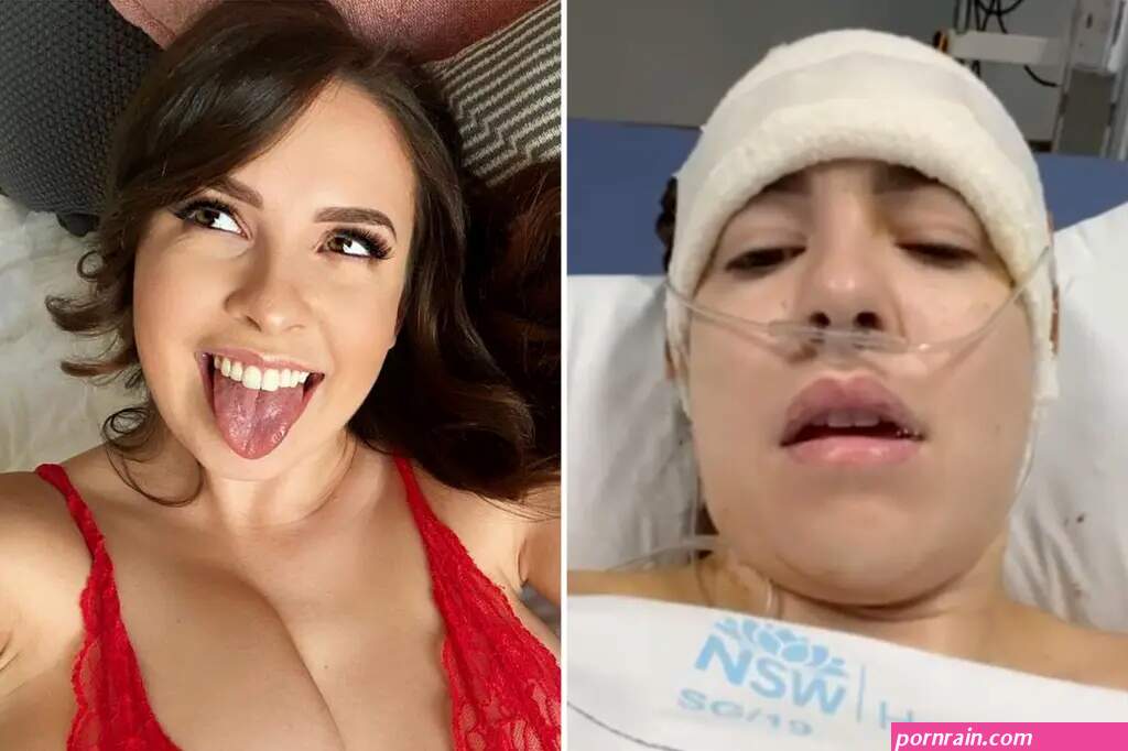 OnlyFans model has brain surgery kept taking nudes in hospital