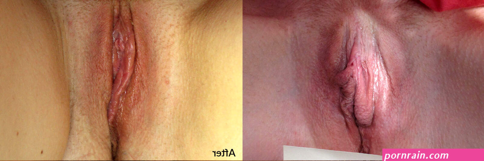 Before After Photos