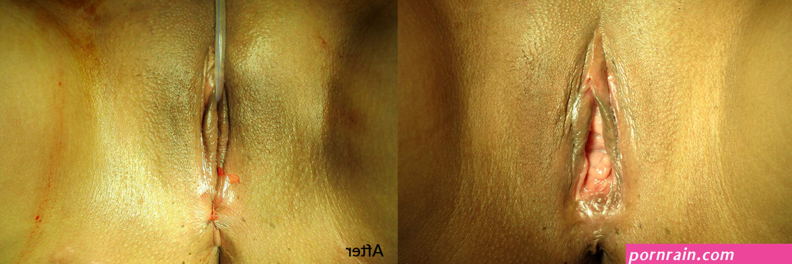 Before After Photos