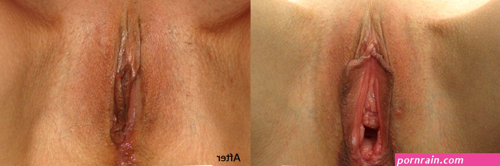 Before After Photos