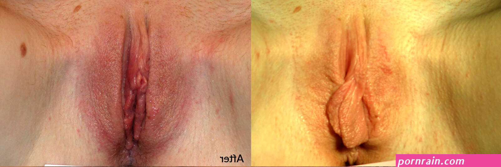 Before After Photos