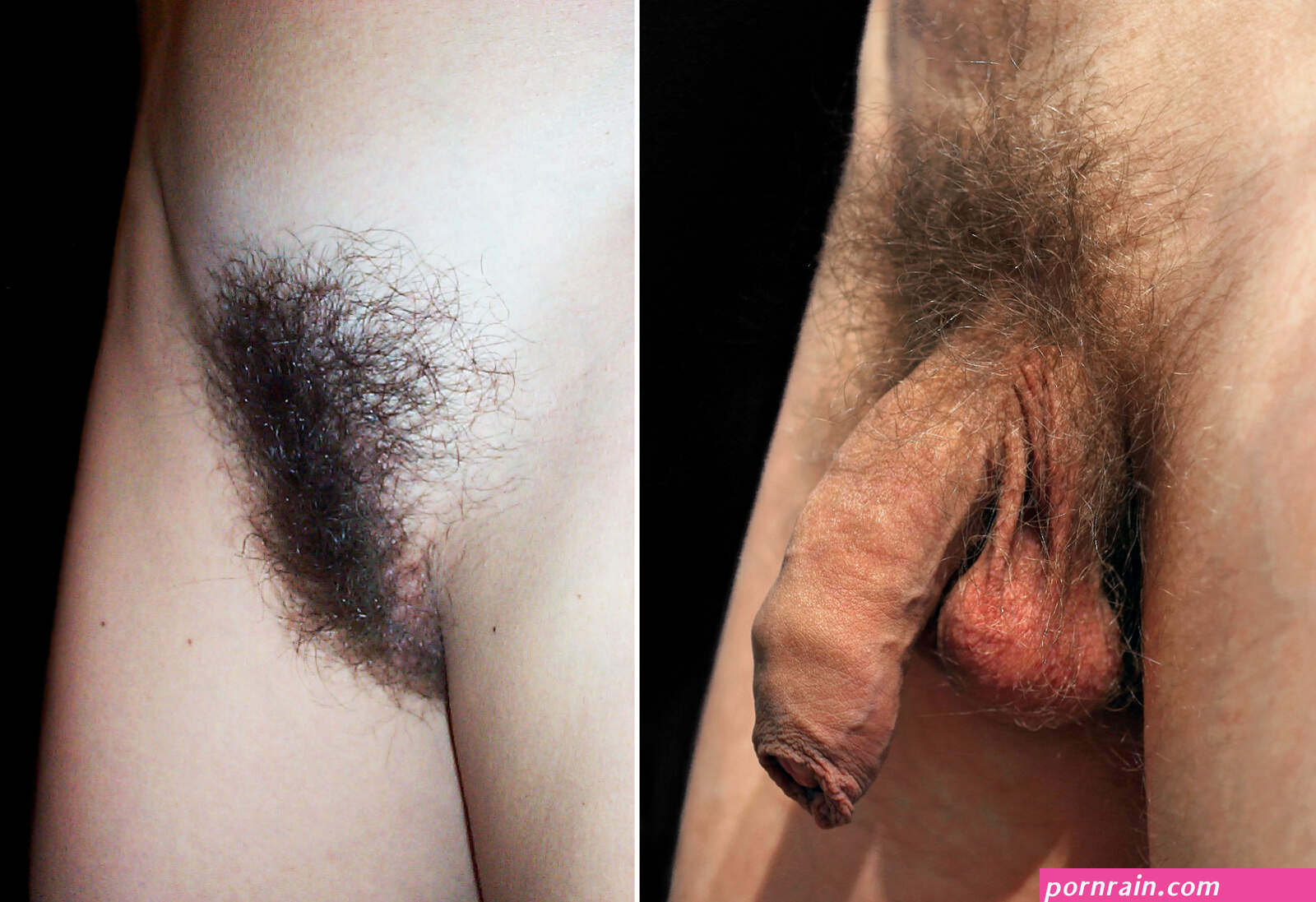 Pubic hair