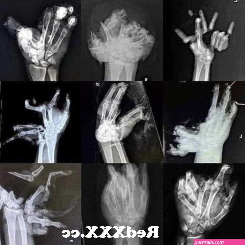 X-rays: Hands Fireworks No No from tamil actress seetha hd x rays nude boobsss indian anty xxx Post