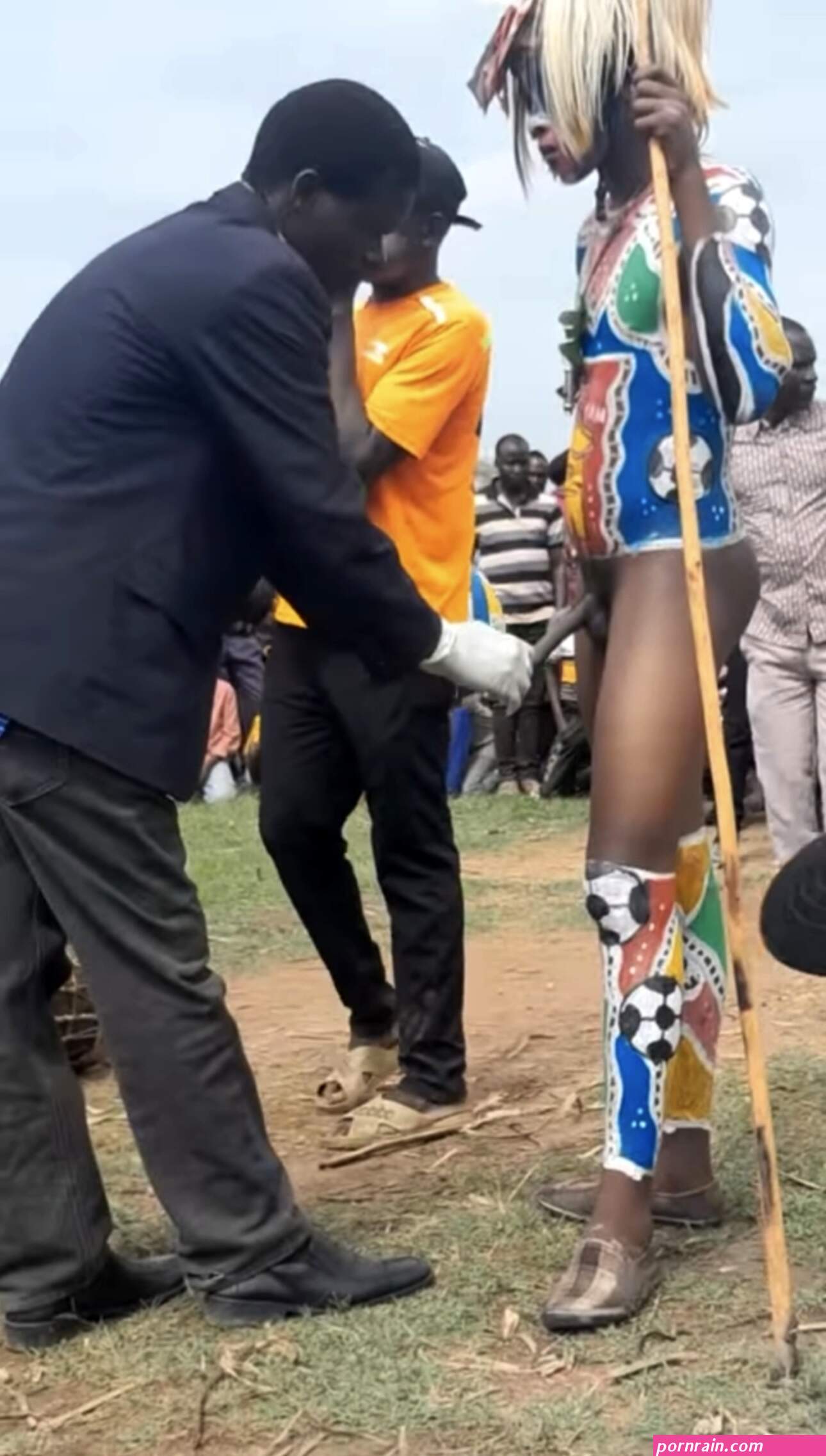 Big Dicks: African teen circumcised IN PUBLIC!