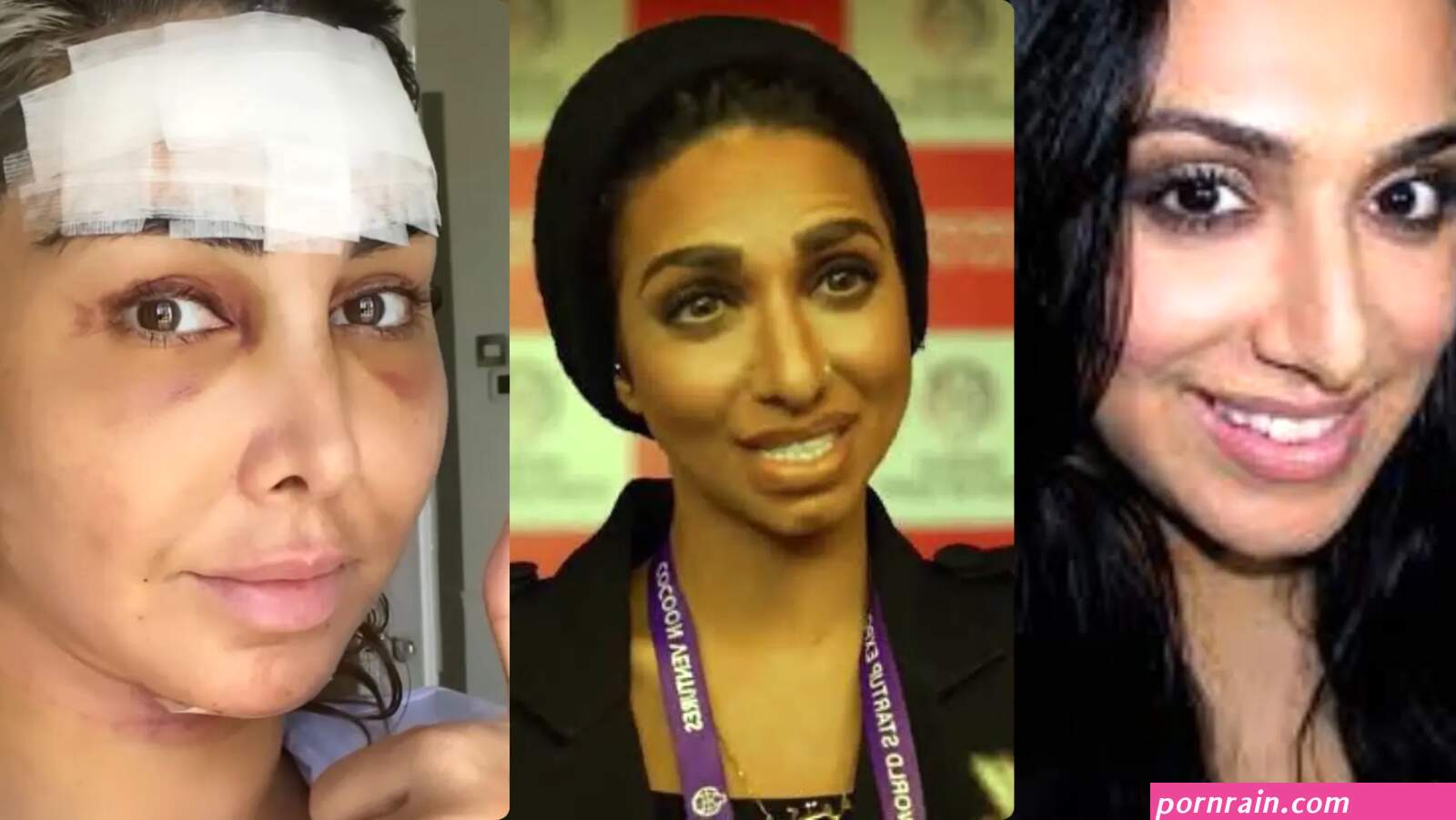 Arab Influencers: Going Under the Knife for that Natural Look