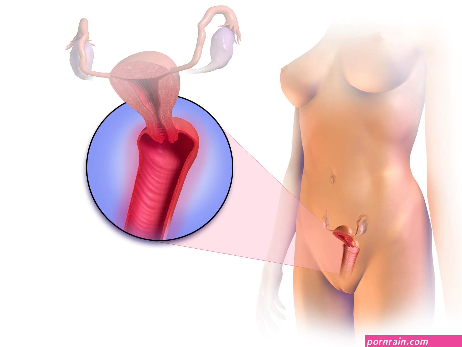 File:Vaginitis.png
