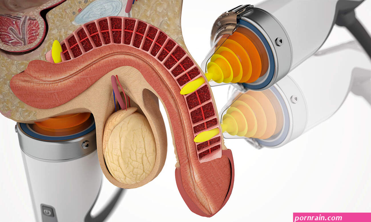 How shock waves can help with erectile dysfunction