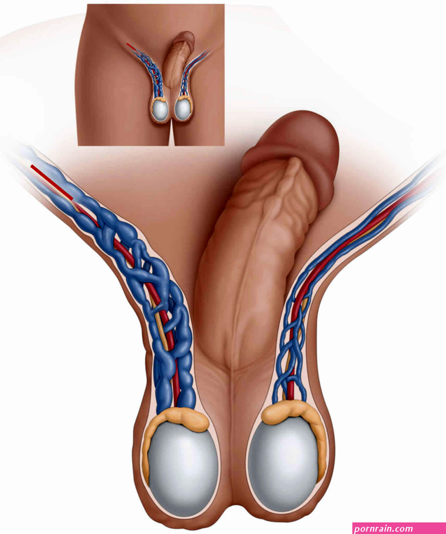 Varicocele causes symptoms diagnosis treatment varicocele pain relief