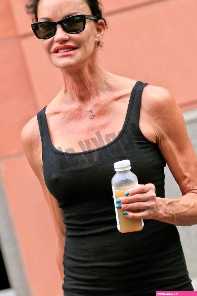 Hroziv nsledok spackanch plastk: Z krsnej supermodelky je vyciven kostra!