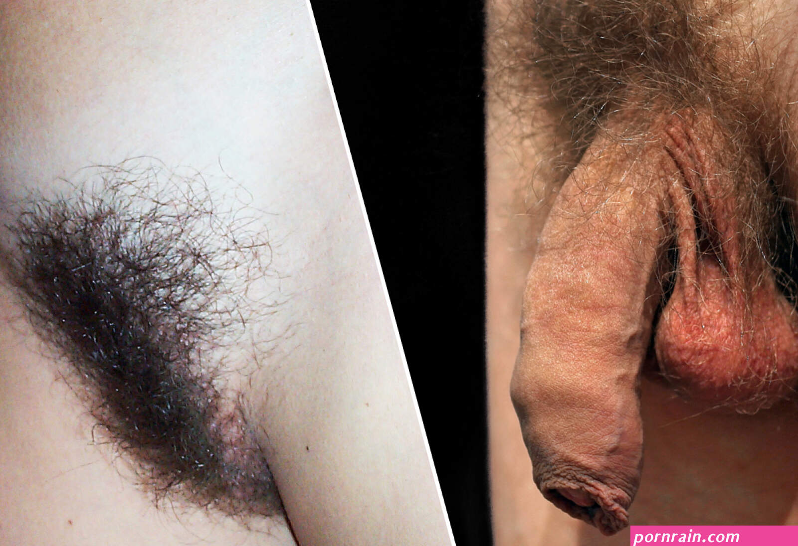 Pubic hair