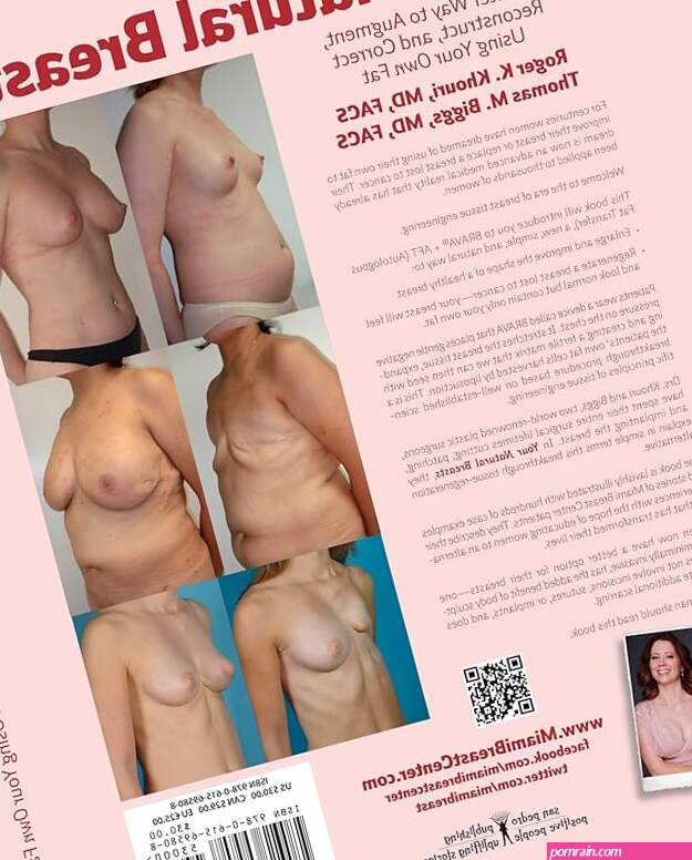 Your Natural Breasts: A Better Way to Augment Reconstruct and Correct Using Your Own Fat : Roger K. Khouri Thomas M. Biggs Patricia San Pedro Managing Editor Lorraine Fico-White Copyeditor Erik Gonzalez:
