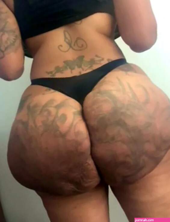 Miss Miami needs 60-inch butt amputated Botched docs say to fix it after illegal jabs went wrong