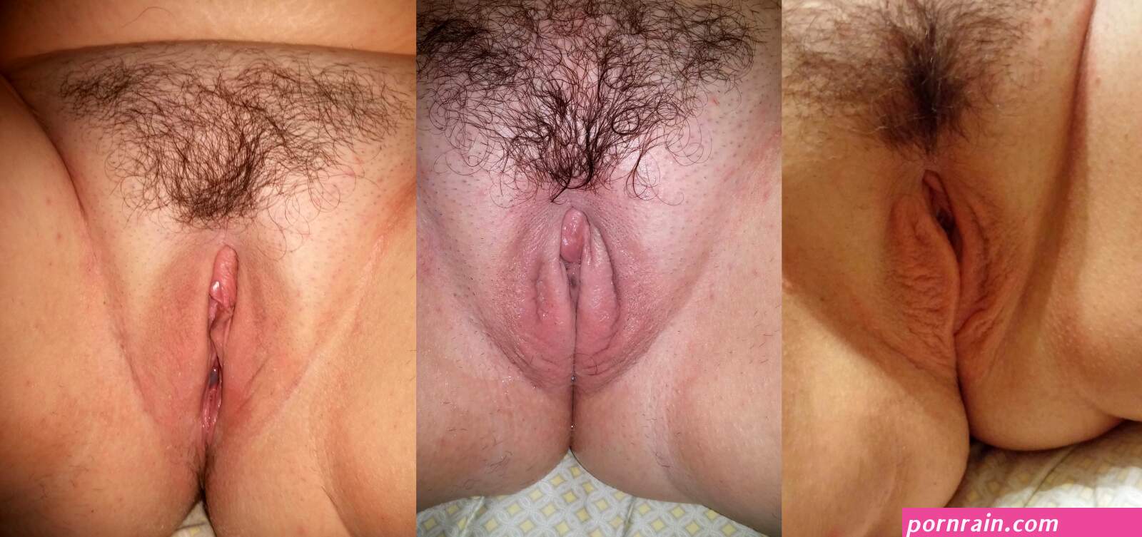 Pussy before and after